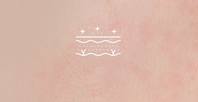 Skizze geröteter, allergischer Haut mit Störfaktoren